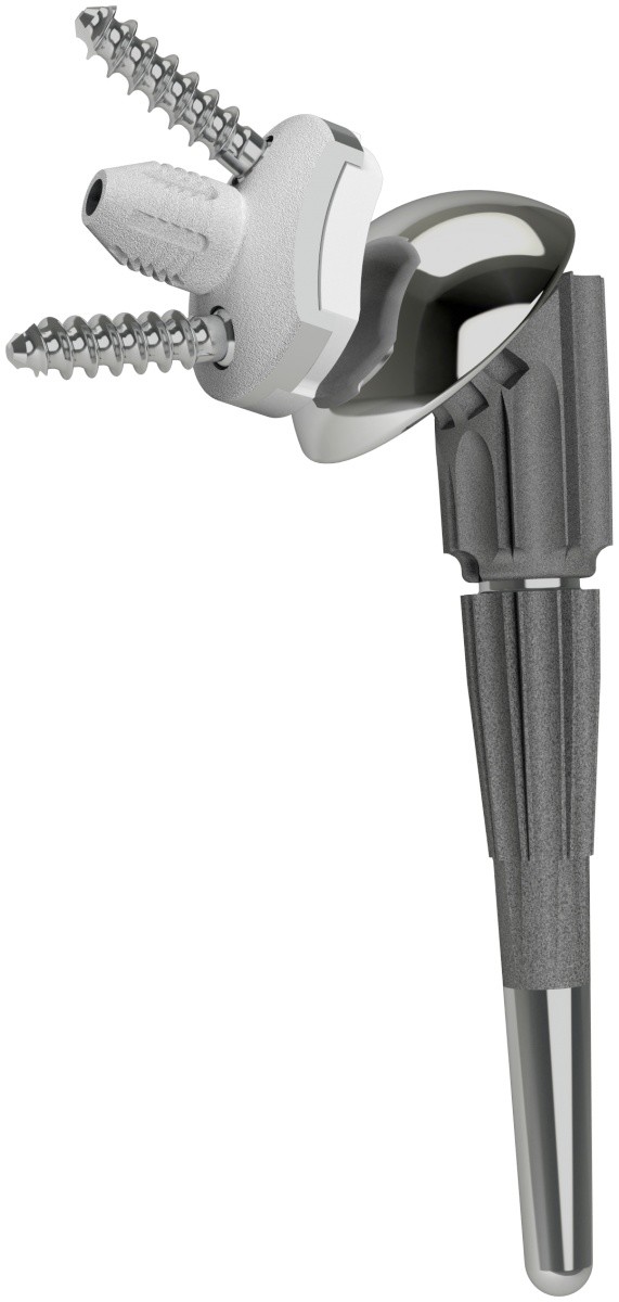 SMR Anatomic image